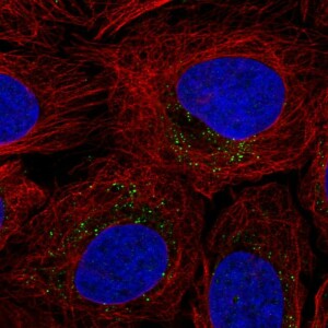 Anti-ROS1, IgG, Rabbit, Polyclonal