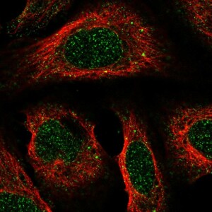 Anti-ACKR2, IgG, Rabbit, Polyclonal