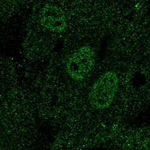 Anti-TAL1, IgG, Rabbit, Polyclonal