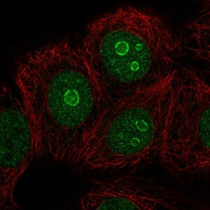 Anti-METTL22, IgG, Rabbit, Polyclonal