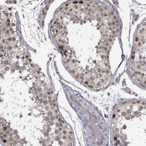 Anti-CHFR, IgG, Rabbit, Polyclonal