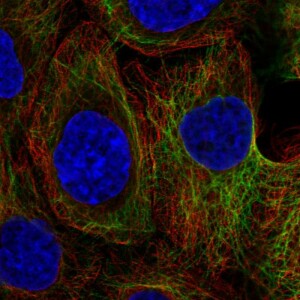 Anti-KRT80, IgG, Rabbit, Polyclonal