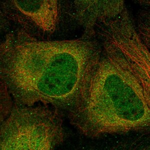 Anti-CSNK2A2, IgG, Rabbit, Polyclonal