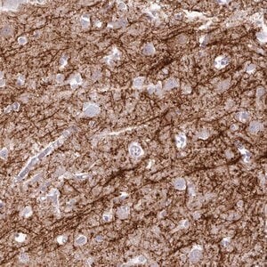 Anti-BDKRB2 antibody produced in rabbit Prestige Antibodies® Powered by Atlas Antibodies, affinity isolated antibody, buffered aqueous glycerol solution
