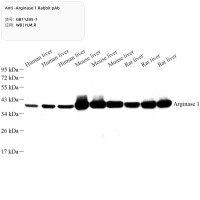 Anti-Arginase 1 Rabbit pAb
