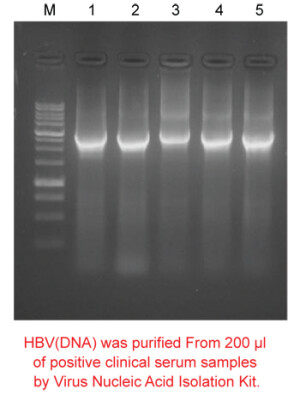 Virus Nucleic Acid Isolation Kit, bundle 16 kits