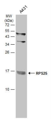 RPS25 Антитела